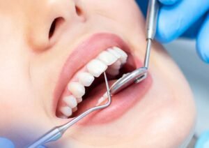 Cosmetic Dentistry