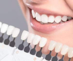 White Teeth